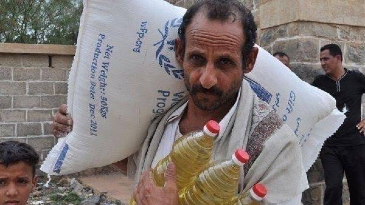 نصف النازحين في اليمن يواجهون سوء التغذية